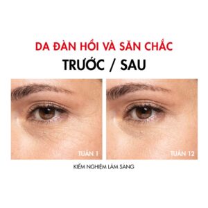 VICHY