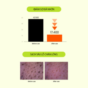 Sữa rửa mặt Đậu Xanh BEPLAIN