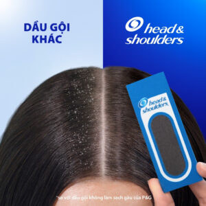 Dầu Gội Sạch Gàu HEAD & SHOULDERS